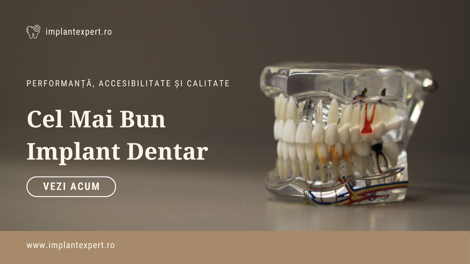 Cel mai bun implant dentar este doar acela cel mai potrivit pentru tine.